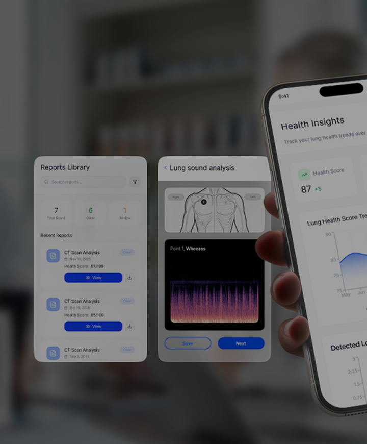 Phone screens of the ChestPal medical app